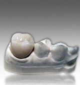 Full Zirconia Crown