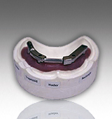 Titanium Implant Bar